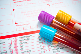 Blutproben in Glasbehältern liegen auf einem medizinischen Formular